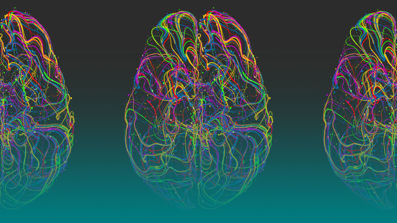 Grafik: Buntes, abstraktes Gehirn